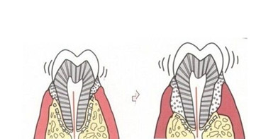 牙齒治療類價格詳情