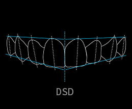 DSD數字美齒設計